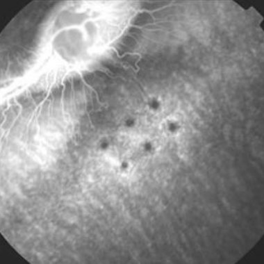 Rabbit fundus angiogram, CNV with vehicle
