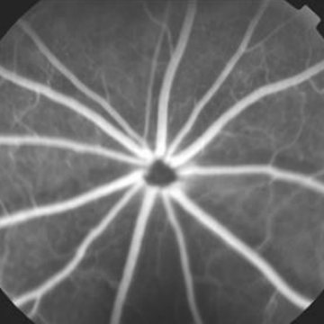 Fundus angiogram, normal rat