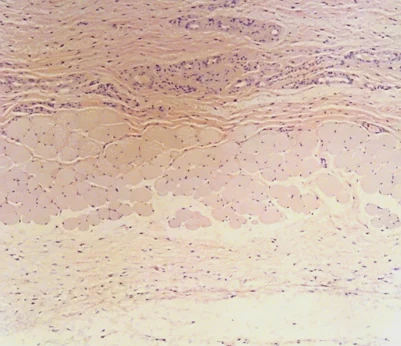 Rabbit injection-site histology after Thermicra SC injection: no remarkable finding